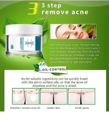 Acne Cream