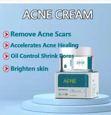 Acne Cream