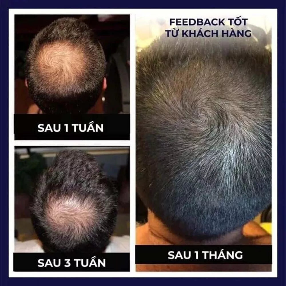 Hair Growth Spray